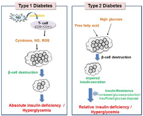 Type 2 diabetes: Beta cells explained .